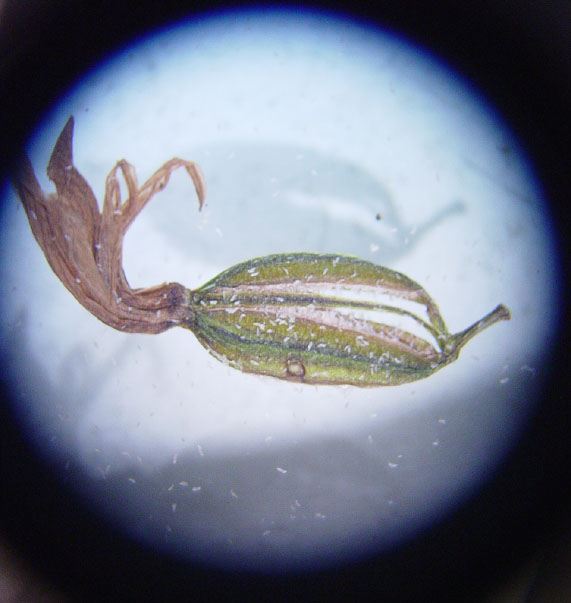 Orchid pod and seeds